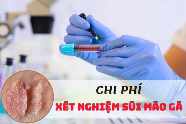 Chi phí xét nghiệm sùi mào gà bao nhiêu tiền?