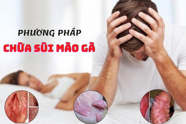 Phương pháp chữa sùi mào gà hiệu quả, an toàn