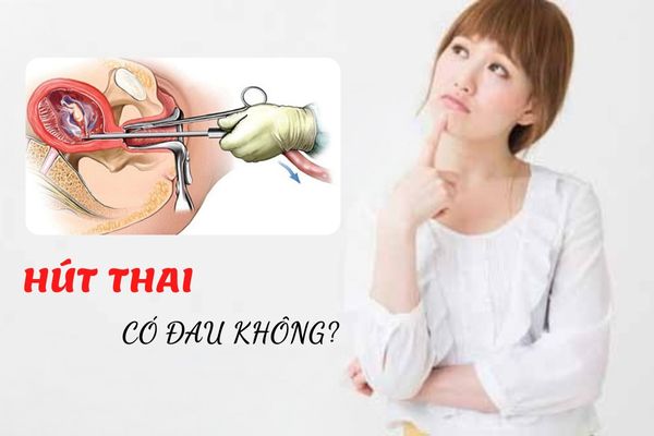 Hút thai có đau không? Quy trình hút thai an toàn