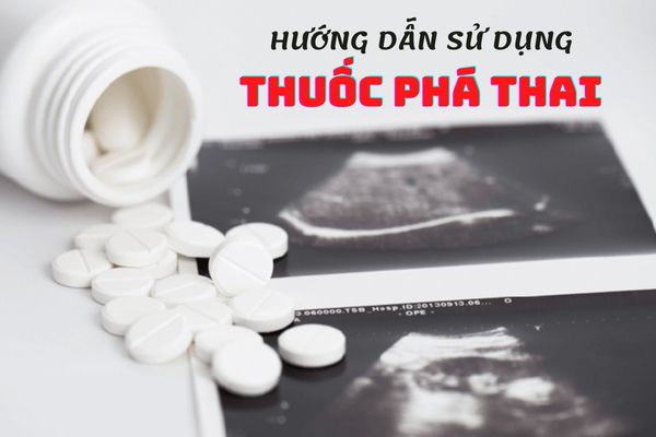 Hướng dẫn cách sử dụng thuốc phá thai đúng cách nhất