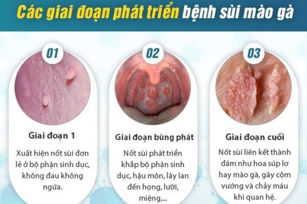 Vì sao nam giới bị chảy máu bao quy đầu?