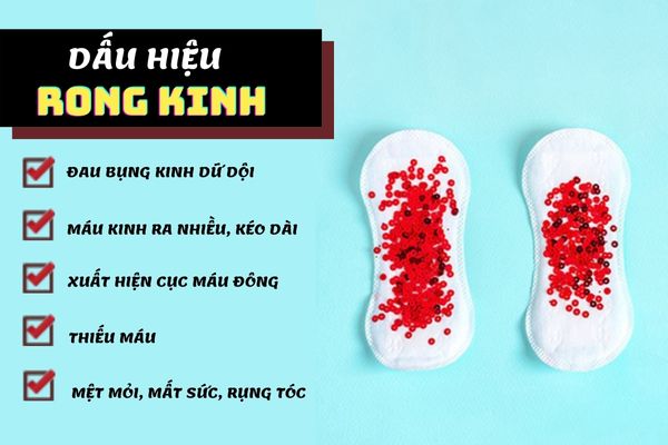 Dấu hiệu nhận biết rong kinh ở nữ giới