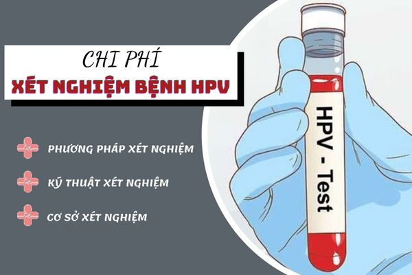 Chi phí xét nghiệm HPV phụ thuộc vào nhiều yếu tố khác nhau