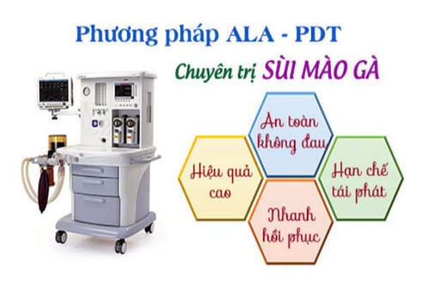 Phương pháp ALA-PDT – Bước tiến hoàn hảo trong điều trị sùi mào gà