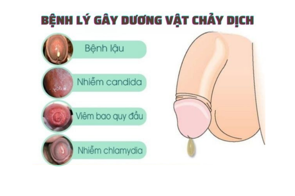 Duong-vat-chay-dich-canh-bao-benh-ly-gi-cach-dieu-tri-hieu-qua-01