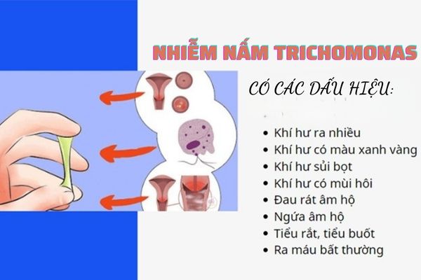 Dấu hiệu rối loạn cương dương – Nhận biết sớm, điều trị hiệu quả