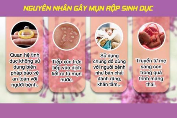 Bệnh mụn rộp sinh dục lây nhiễm qua nhiều con đường khác nhau