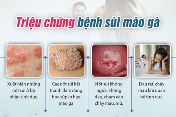 Triệu chứng nhận biết bệnh sùi mào gà