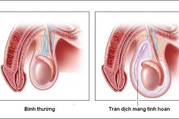 Tran-dich-mang-tinh