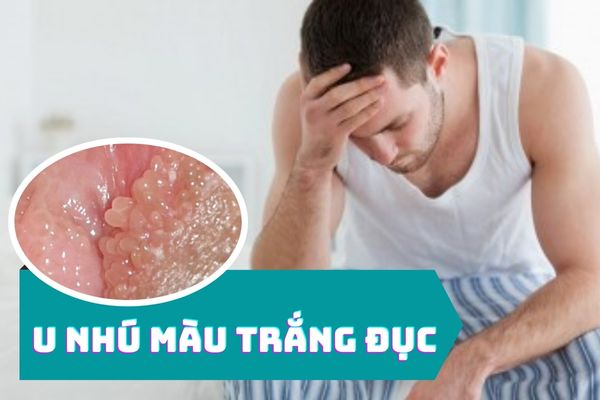 U nhú màu trắng đục cảnh báo bệnh lý gì? Có nguy hiểm không?