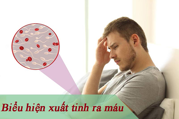 Biểu Hiện Xuất Tinh Ra Máu ở Nam Giới Là Gì?