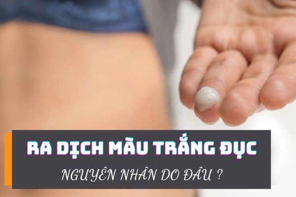 Tại sao nữ giới ra dịch trắng đục – Cách điều trị hiệu quả