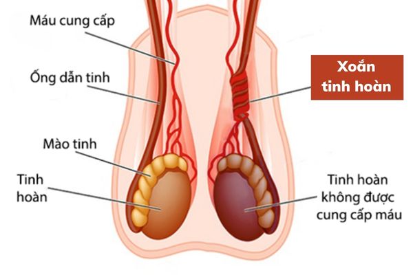 Benh-tinh-hoan-thuong-gap (3)