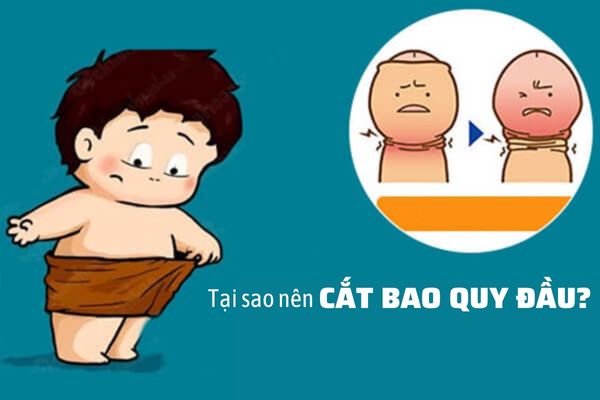 Cắt bao quy đầu là như thế nào? Vì sao nên cắt bao quy đầu?