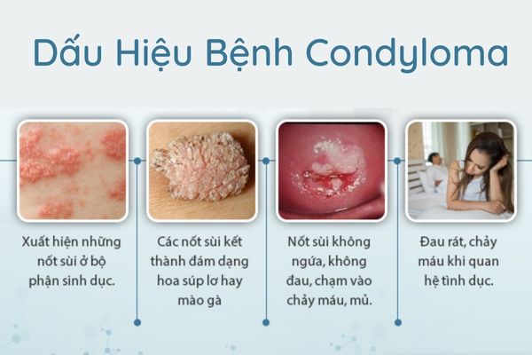 Condyloma-can-benh-nguy-hiem-rat-pho-bien-hien-nay-1