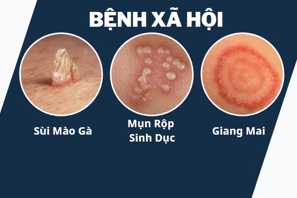 Mun-duong-vat-canh-bao-dieu-gi-1