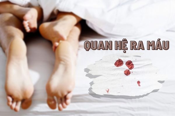 Quan hệ ra máu – Nguyên nhân và cách khắc phục