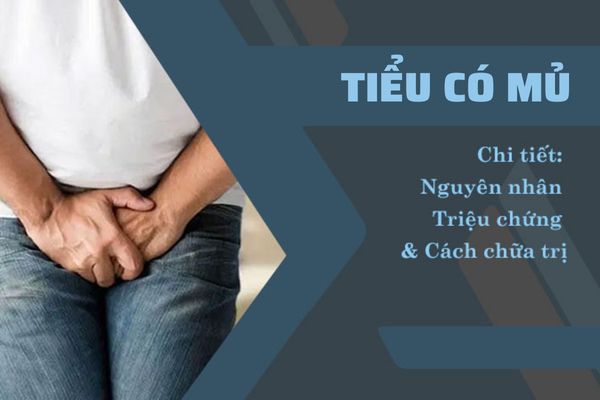 Tiểu có mủ – Cảnh báo bệnh lý cần điều trị ngay