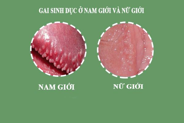 Tong-hop-nhung-su-that-ve-gai-sinh-duc-2