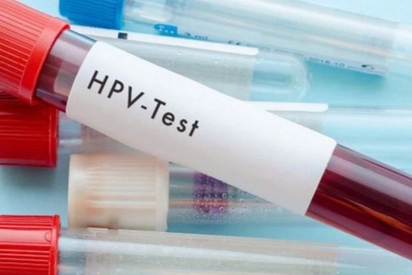 Virus-hpv-gay-benh-nguy-hiem-de-doa-tinh-mang-2