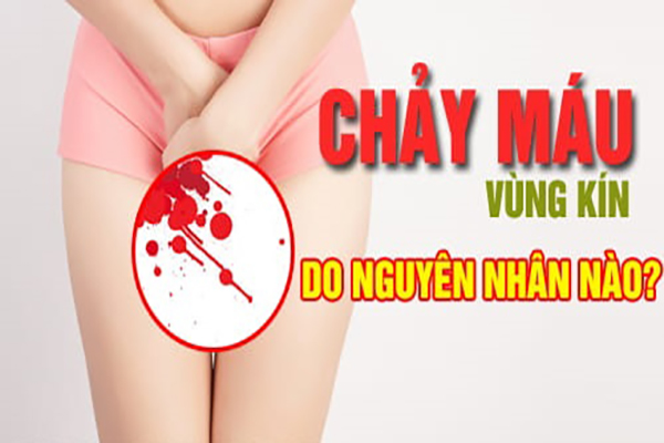 Âm đạo bị chảy máu bất thường – Nỗi ám ảnh của nhiều chị em