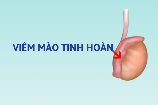 Benh-o-tinh-hoan-su-be-tac-lon-cua-phai-manh-2