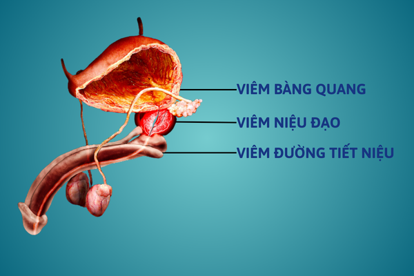 Diem-danh-cac-benh-duong-vat-pho-bien-hien-nay-5