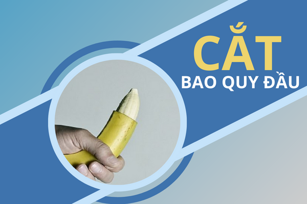 Thực hiện cắt bao quy đầu cần lưu ý gì?