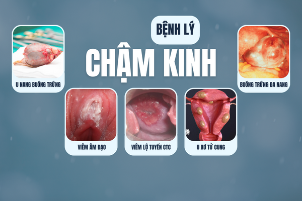 Cham-kinh-can-than-khong-chi-la-mang-thai-1