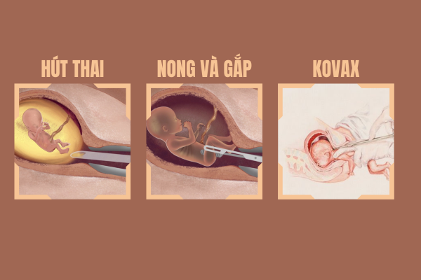 Cac-phuong-phap-pha-thai-an-toan-bao-mat-tiet-kiem-2