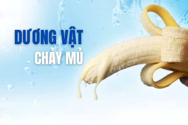 Dương vật chảy mủ là bị gì?