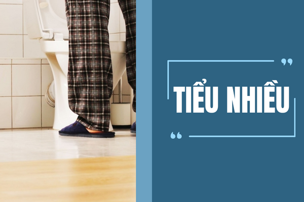 Tiểu nhiều là thế nào và nguyên nhân gì gây ra?