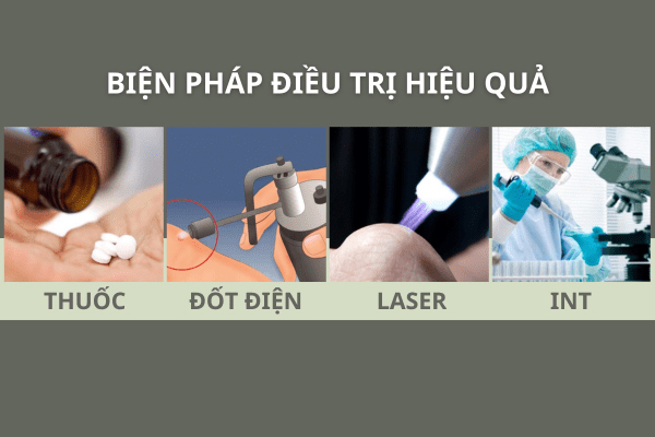 Phương pháp chữa trị mụn rộp nam hiệu quả