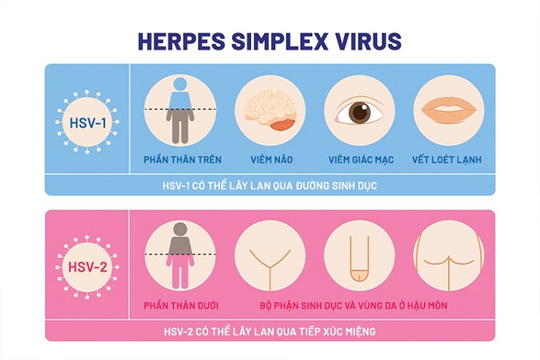 Herpes Simplex Virus có 2 type gây bệnh