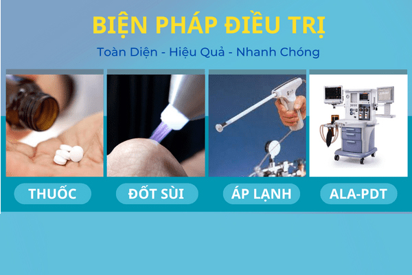 Cách khắc phục bệnh sùi mào gà ở nam hiệu quả