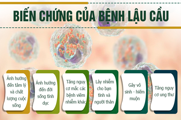 Chú ý bệnh lậu mãn tính tránh biến chứng nguy hiểm