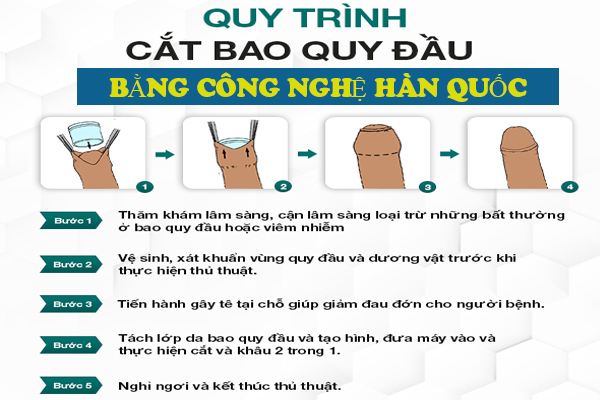 Quy trình cắt bao quy đầu bằng phương pháp tiên tiến không đau tại Trường Hải