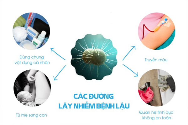 Tổng hợp các hình ảnh bệnh lậu qua từng giai đoạn