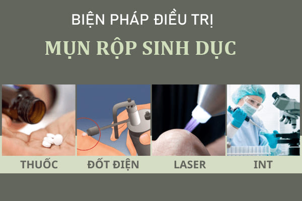 Điều trị mụn rộp sinh dục như thế nào hiệu quả?