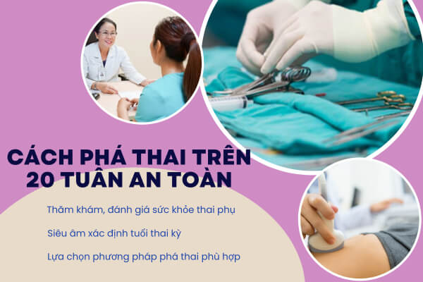 Thực hiện phá thai trên 20 tuần như thế nào? Tư vấn cách phá thai an toàn