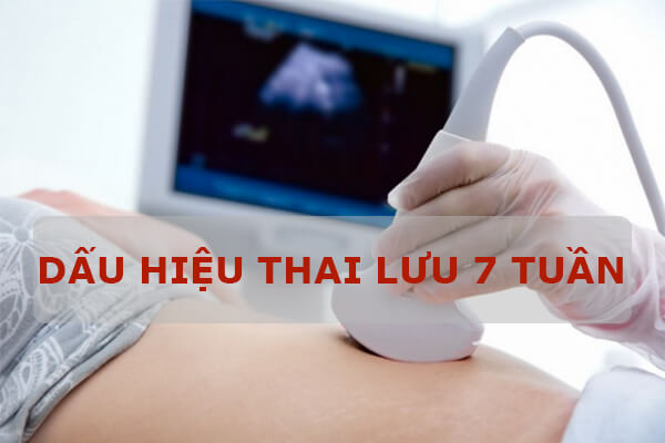 Dấu hiệu thai lưu 7 tuần