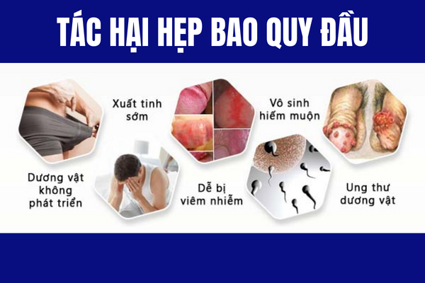 Hep-bao-quy-dau-hoi-chung-nguy-hiem-pho-bien-o-nam-gioi-3