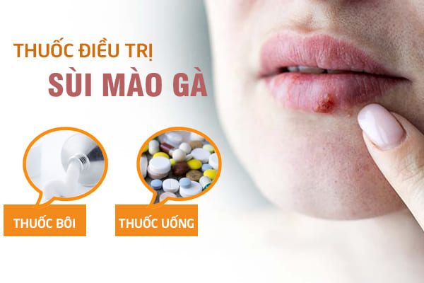 Su-dung-thuoc-sui-mao-ga-co-thuc-su-hieu-qua-khong-1