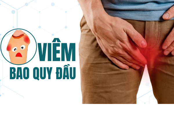 Viêm bao quy đầu phổ biến và nguy hiểm