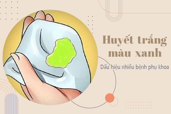 Vùng kín ra dịch xanh dấu hiệu bất thường