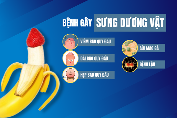 Benh-gay-sung-duong-vat-hieu-qua