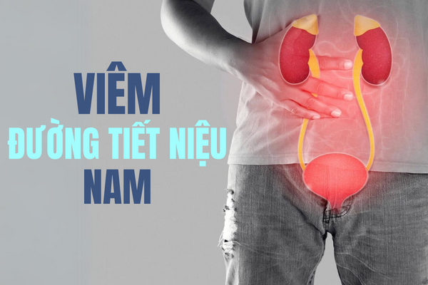 Biết rõ viêm đường tiết niệu nam giúp trị hiệu quả.