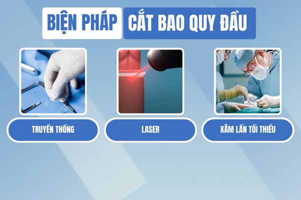 Cat-bao-quy-dau-bien-phap