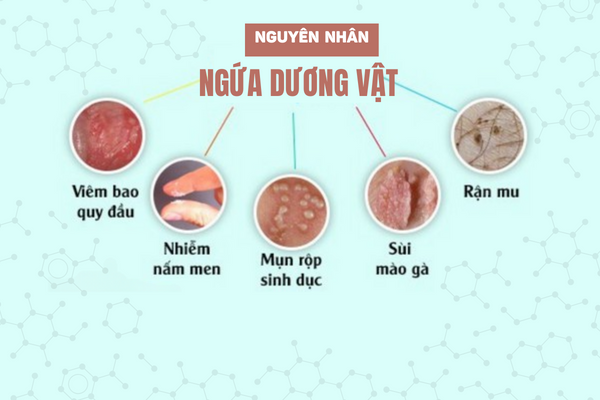 Dau-la-nguyen-nhan-ngua-duong-vat-2