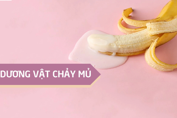 Dương vật chảy mủ là bị bệnh gì? Có sao không?